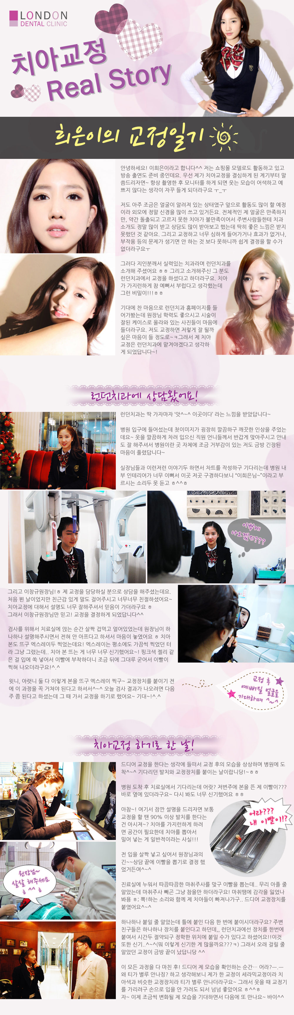 이희은 치아교정1.jpg